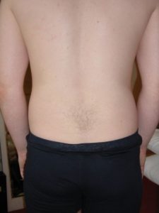 Image used under a Collective Commons License from https://www.needpix.com/photo/666157/back-pain-standing-person-backache-ache